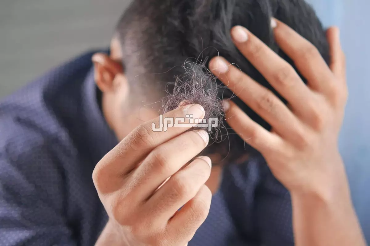 تفسير حلم تساقط الشعر للعزباء والمتزوجة هل تساقط الشعر في الحلم خير أم شر؟