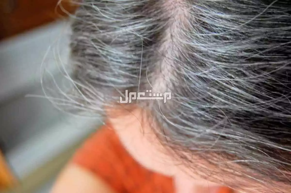 أقوى صبغة للشعر الأبيض 2025 والاسعار كاملة أفضل صبغة لتغطية الشعر الأبيض بالكامل 2025