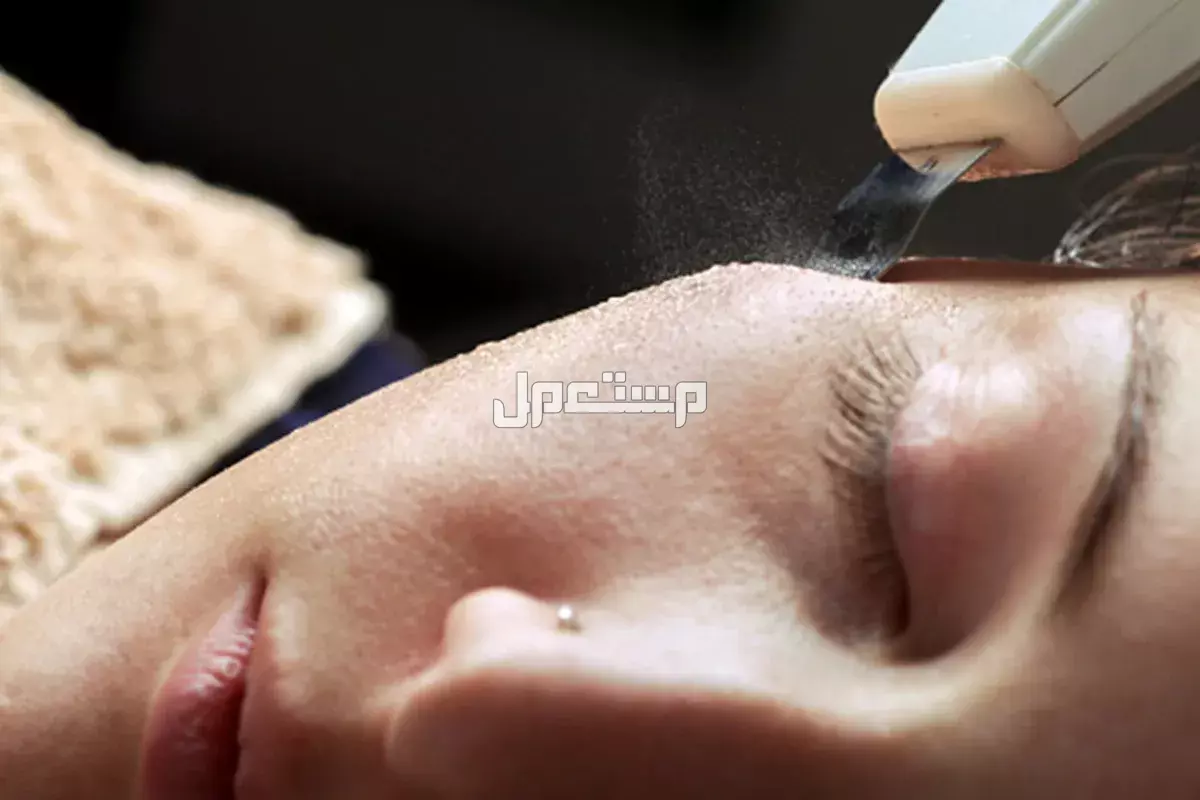 سعر جهاز التراسونيك الأصلي 2025.. وكل ما يخص مميزاته وعيوبه أفضل جهاز لتقشير البشرة