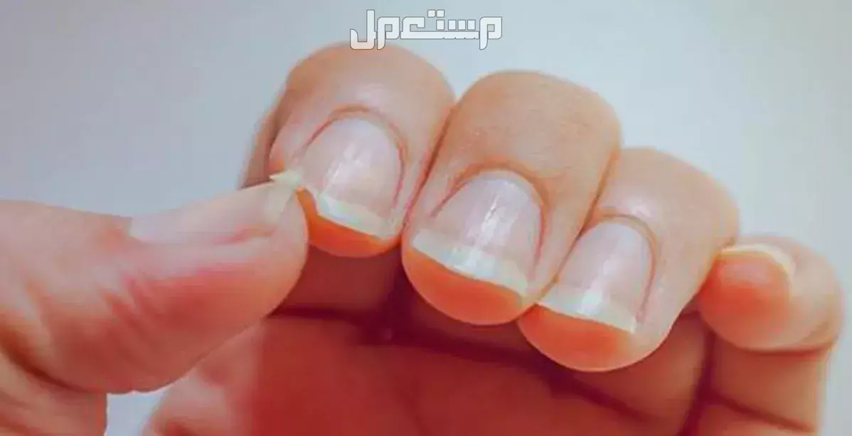 تفسير حلم قص الأظافر في المنام للرجل والمرأة دلالات قص الأظافر في المنام
