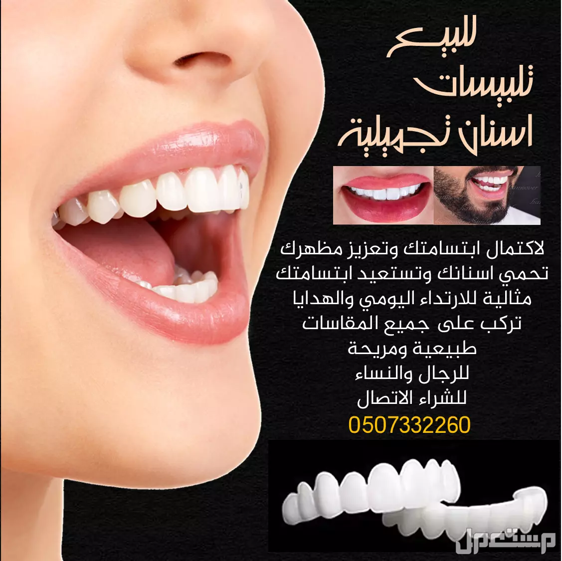للبيـع تلبيسات اسنان تجميلية  لاكتمال ابتسامتك وتعزيز مظهرك