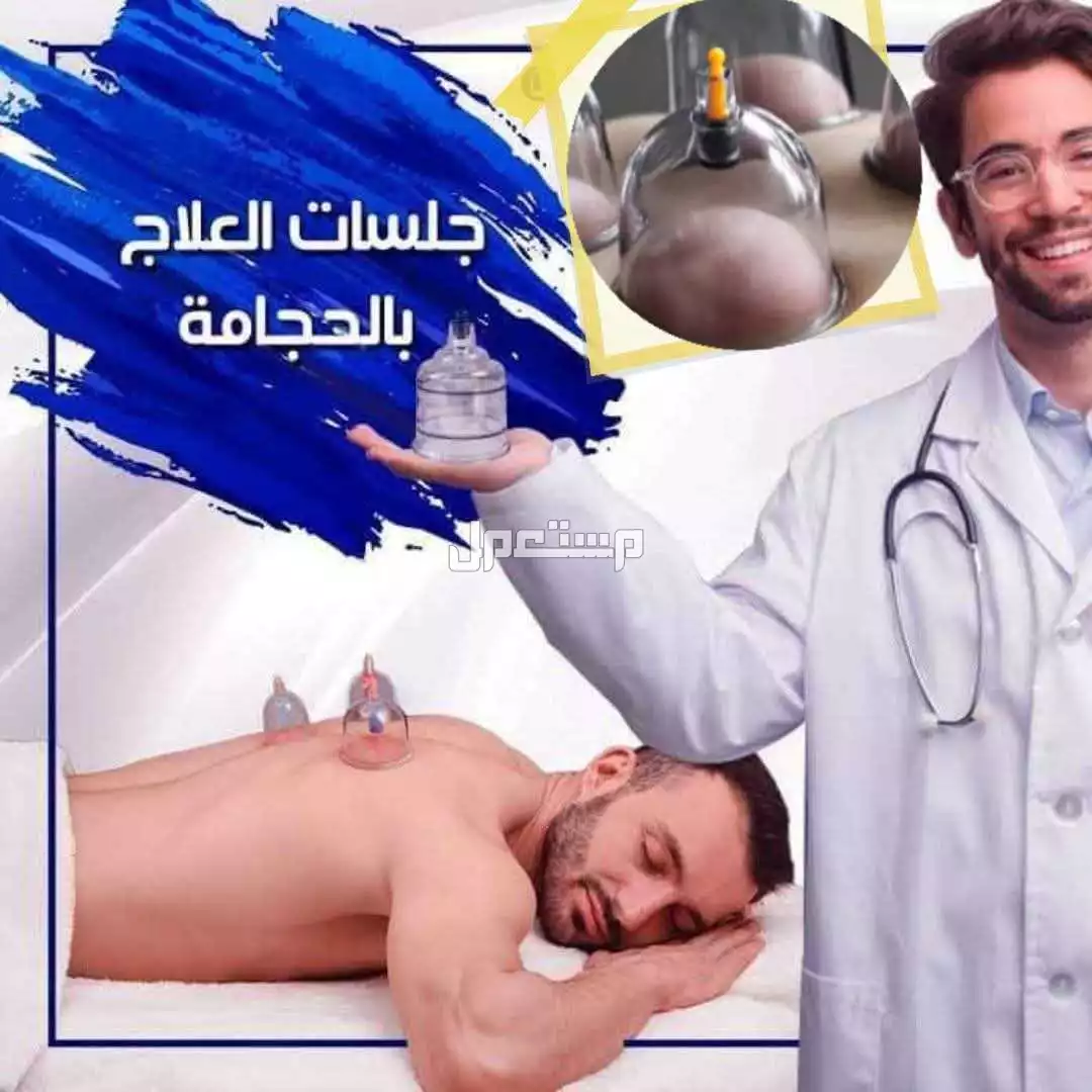 حجامتك  في بريدة بسعر 120 ريال سعودي