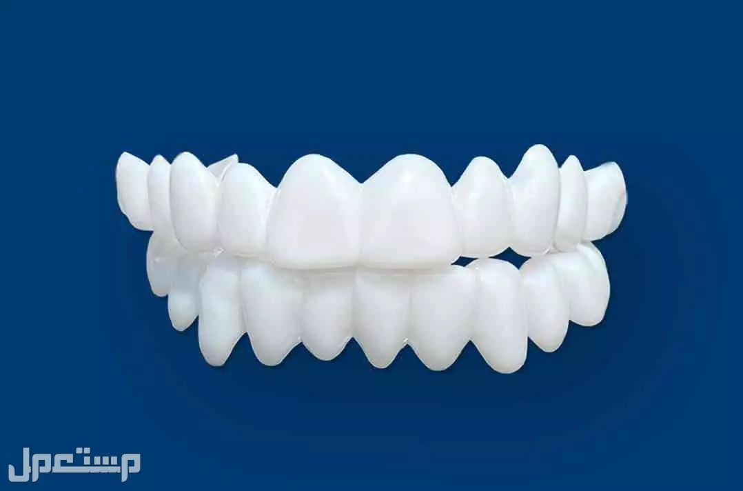 ✨ ابتسامة هوليود المتحركة ✨ (Snap-On Smile) في الرياض