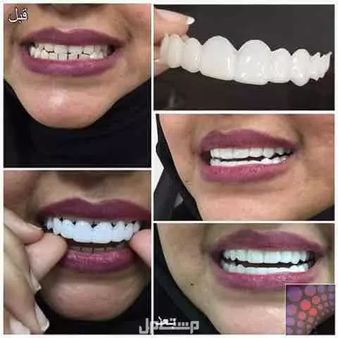 عرووض الابتسامة المتحركة الالمانية