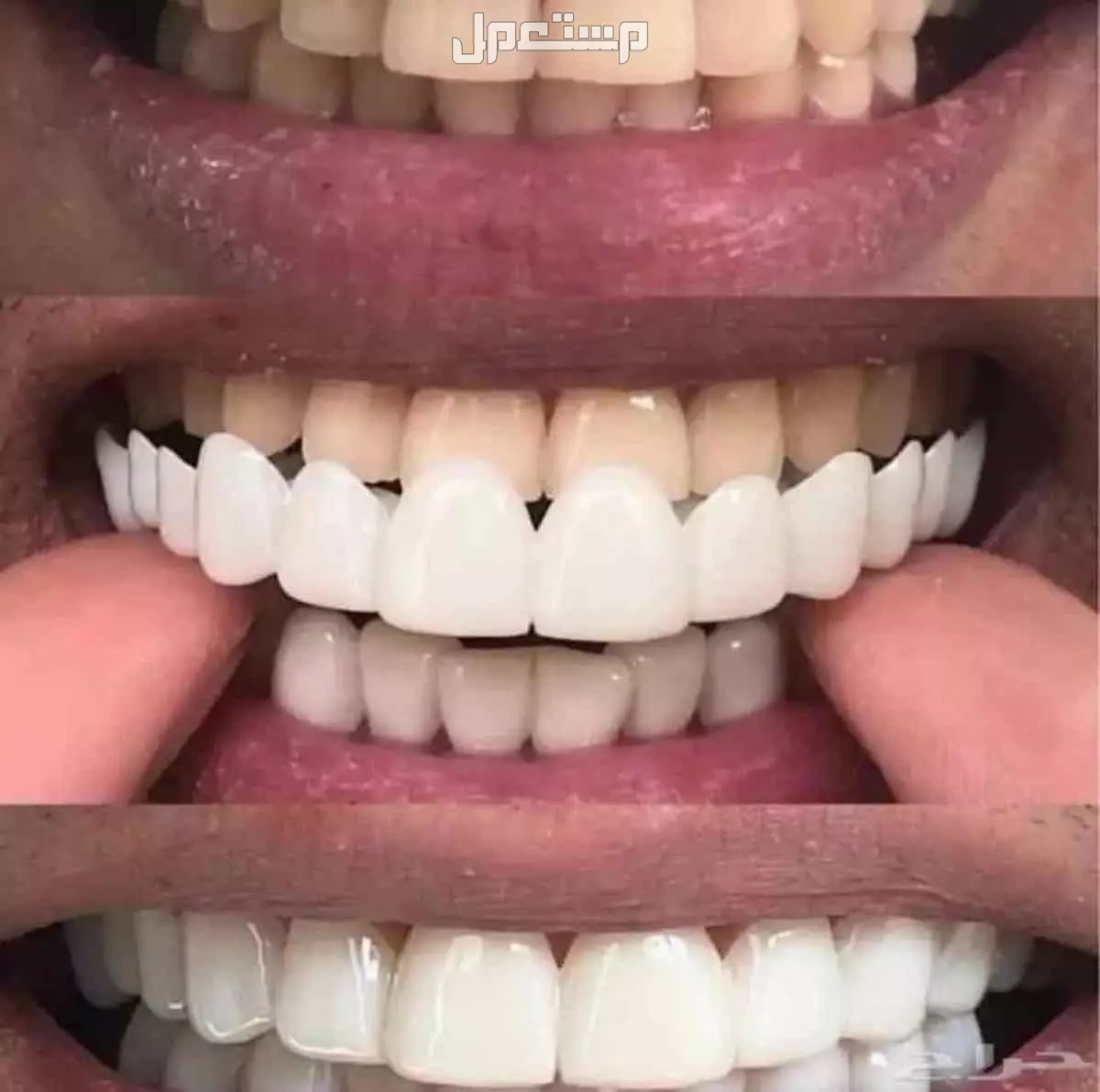 عرووض الابتسامة المتحركة الالمانية