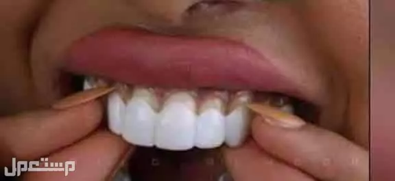 عرووض الابتسامة المتحركة الالمانية