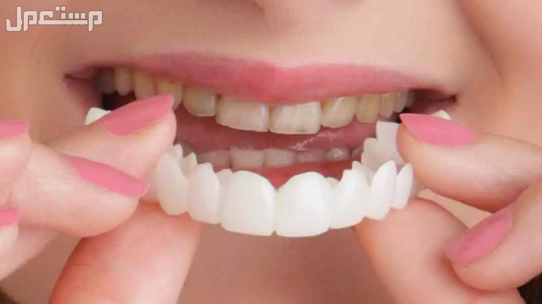 عرووض الابتسامة المتحركة الالمانية