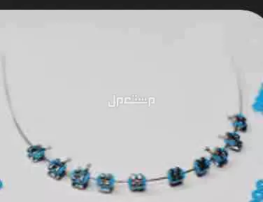 تقويم اسنان زينة في جدة ب 90 ريال